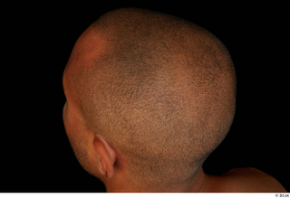 Aaron bald hair 0004.jpg